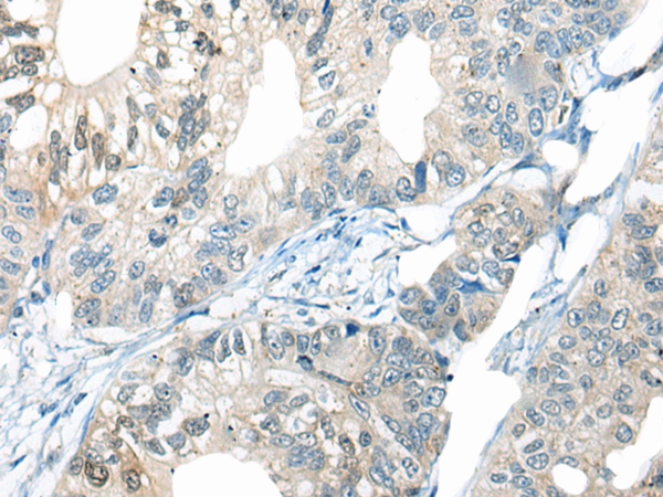 CELF4 Antibody