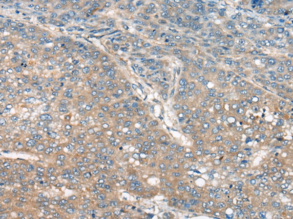 CELSR1 Antibody