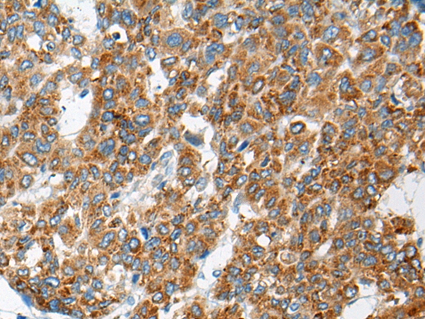 CEP104 Antibody