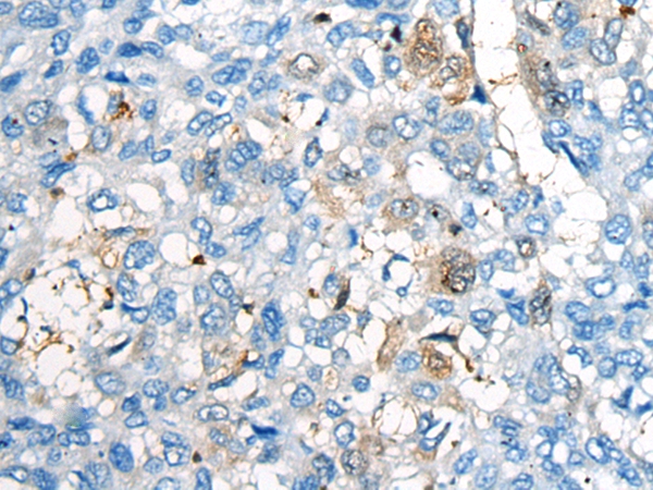 CEP170 Antibody