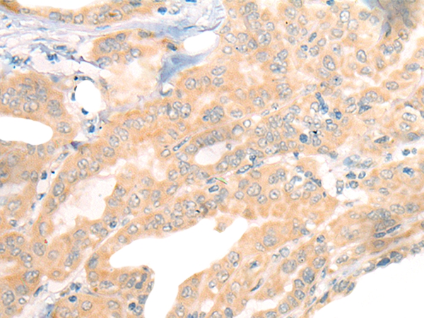 CEP290 Antibody