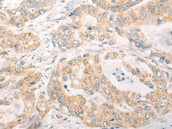 CEP290 Antibody