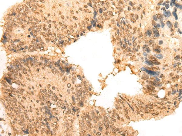 CEP57 Antibody