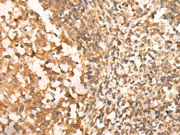 CEP57 Antibody