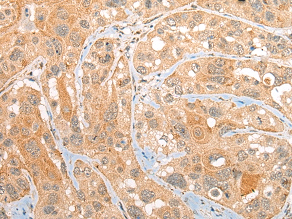 CEP72 Antibody