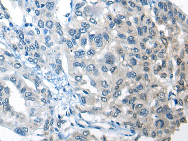 CEP89 Antibody