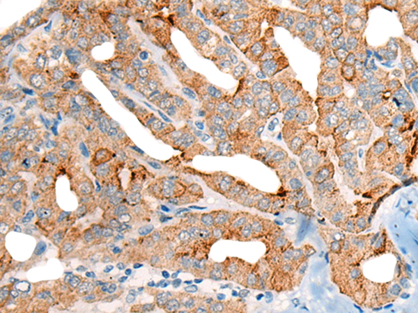 CETN3 Antibody