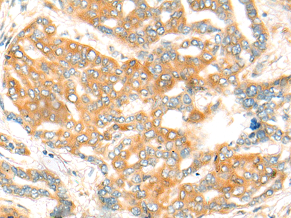 CFHR2 Antibody