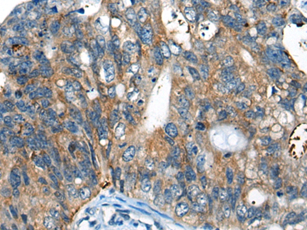 CHADL Antibody