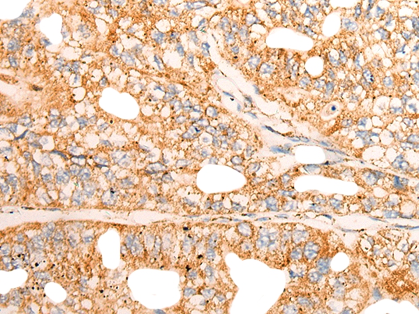 CHCHD3 Antibody