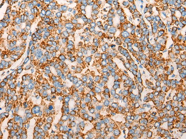 CHCHD3 Antibody