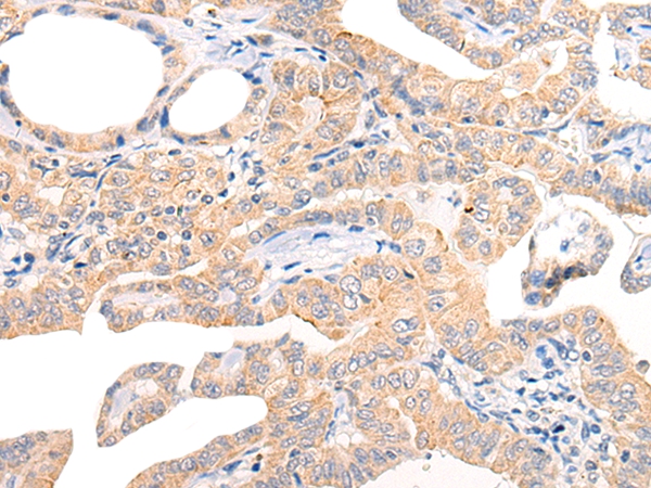 CHCHD5 Antibody