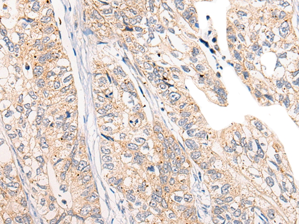 CHCHD5 Antibody