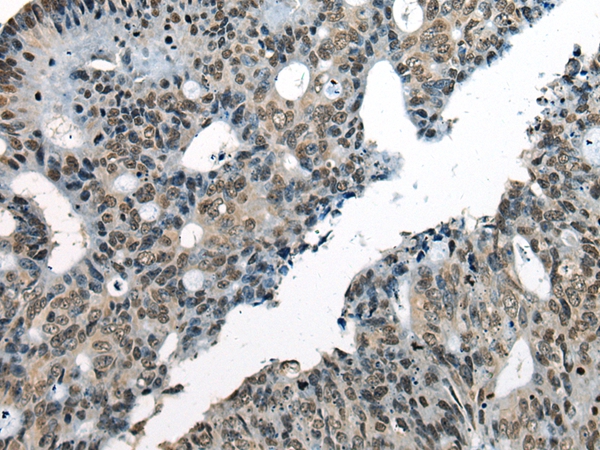 CHD1L Antibody