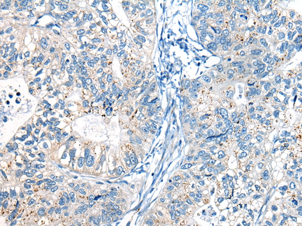 CHM Antibody