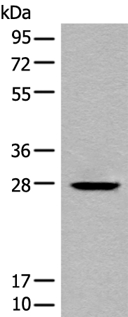 CHODL Antibody