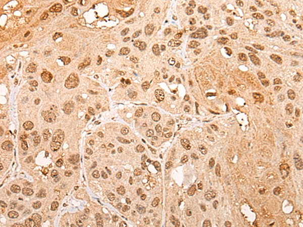 CHRAC1 Antibody