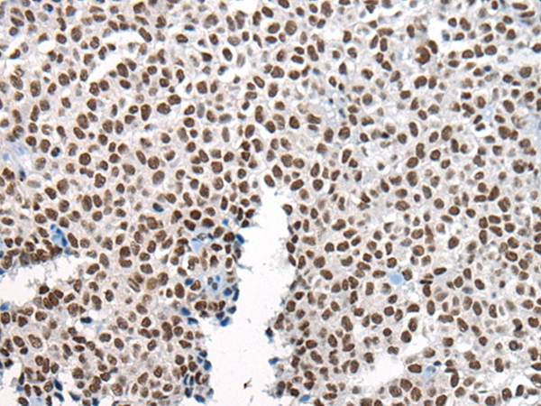 CHURC1 Antibody