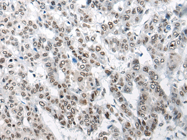 CHURC1 Antibody