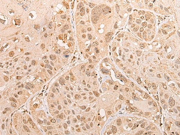 CISD1 Antibody