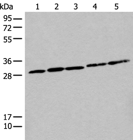 CITED1 Antibody