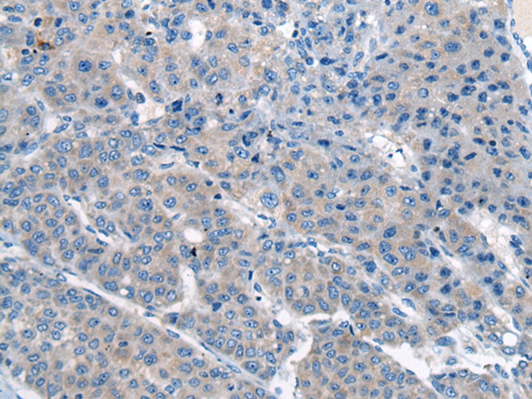 CITED4 Antibody