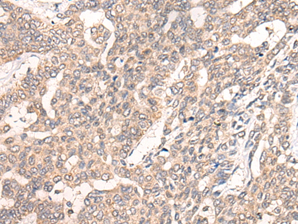 CLASP1 Antibody