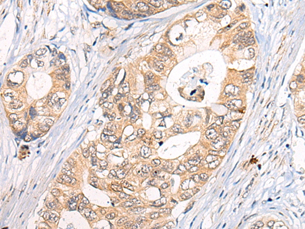 CLPTM1 Antibody