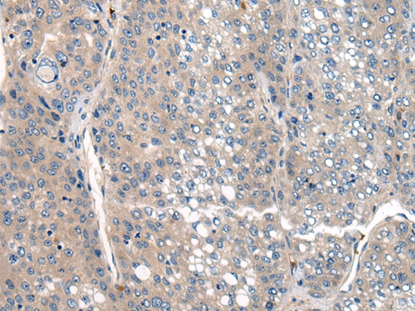 CLTCL1 Antibody