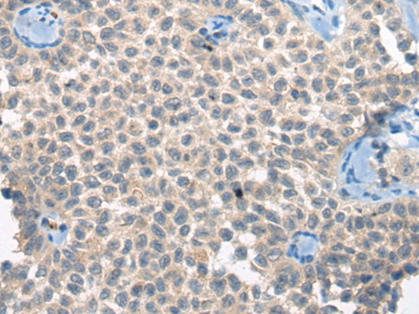 CLTCL1 Antibody