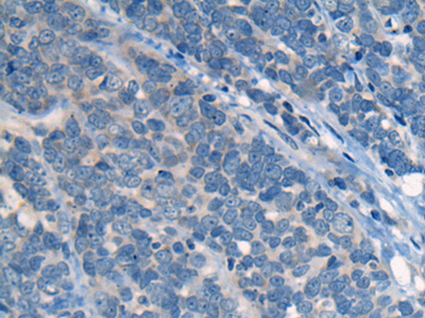 CNGA3 Antibody