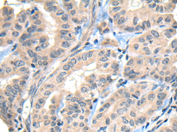 CNN1 Antibody