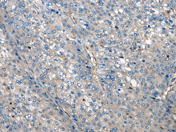 CNOT4 Antibody