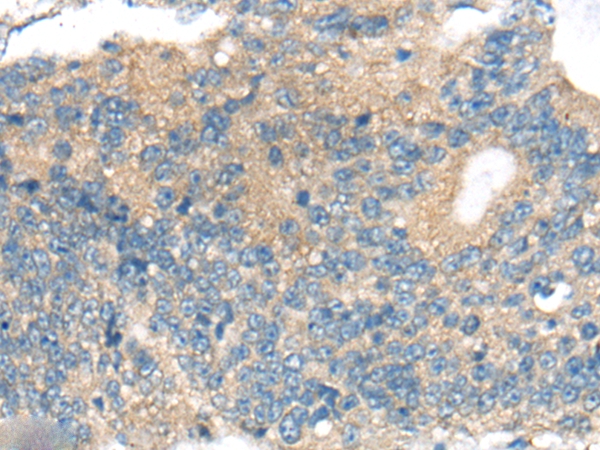 CNTNAP1 Antibody