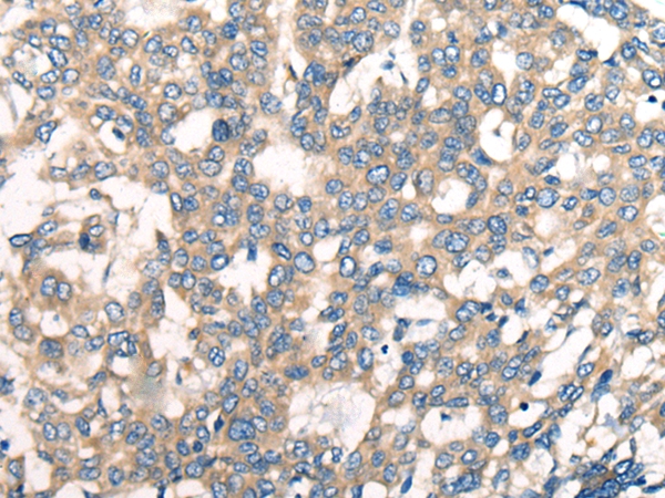 CNTNAP1 Antibody