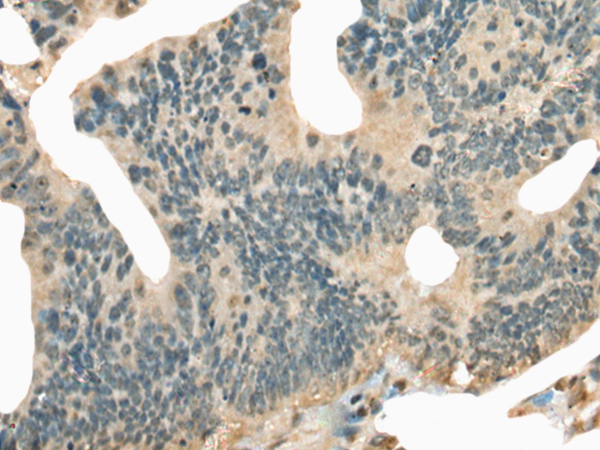 CNTNAP2 Antibody