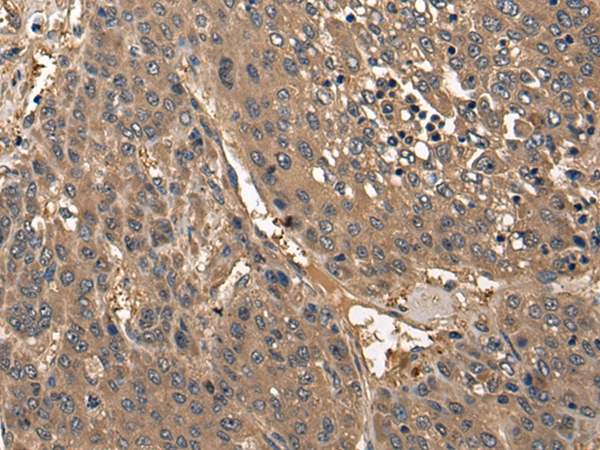 COL25A1 Antibody