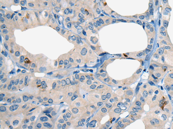 COL5A2 Antibody