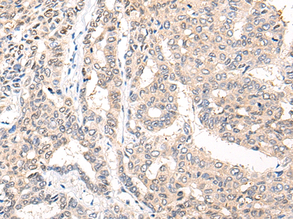 COL9A1 Antibody