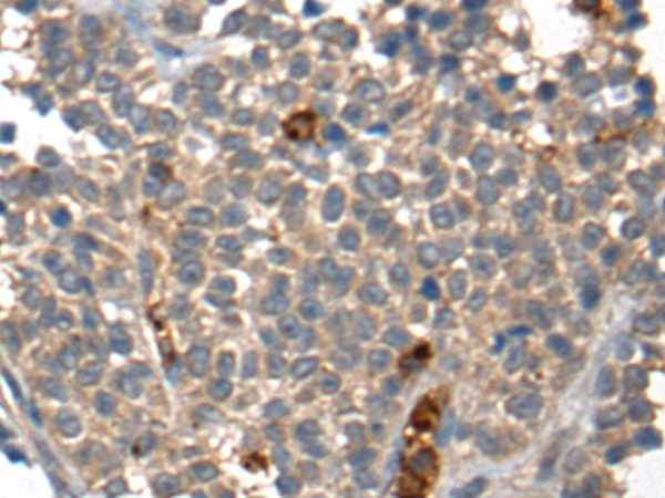 CORO1A Antibody