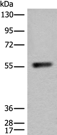 CORO1A Antibody