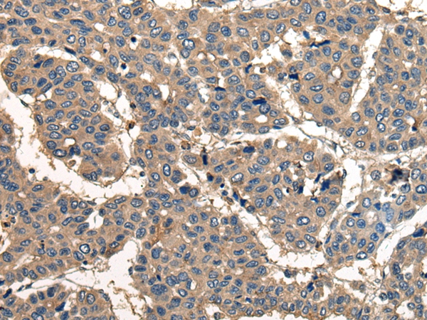 CORO1B Antibody