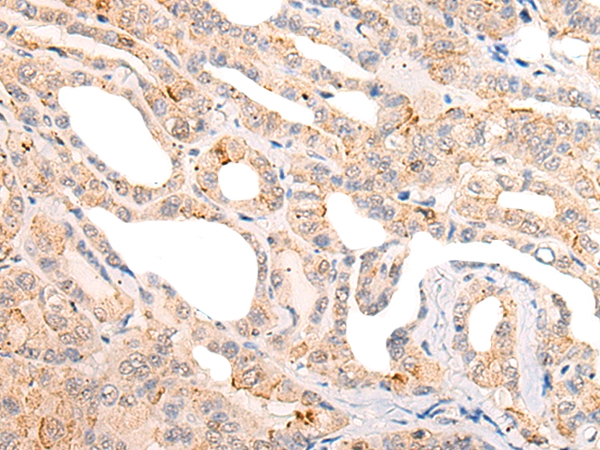 CORO6 Antibody