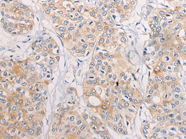 CPD Antibody