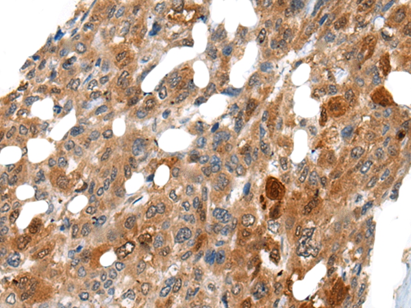 DNASE1L2 Antibody