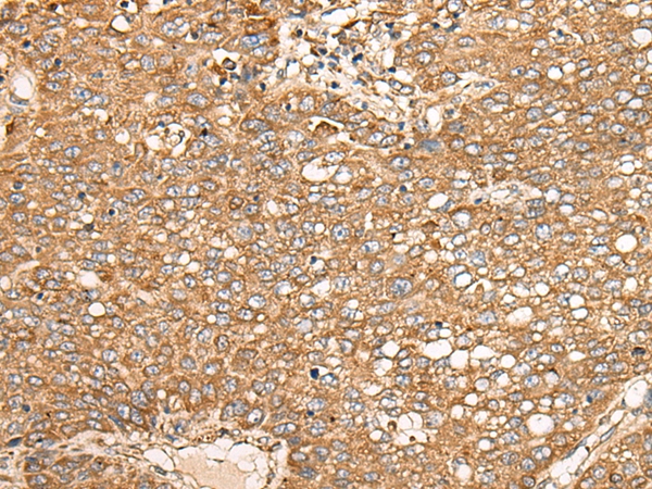 EDEM2 Antibody