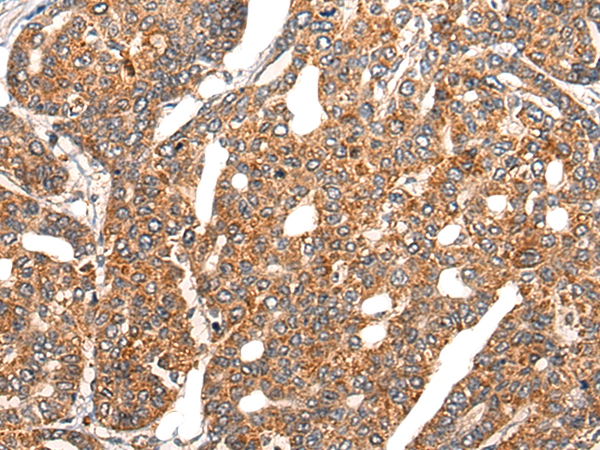 EPHA6 Antibody