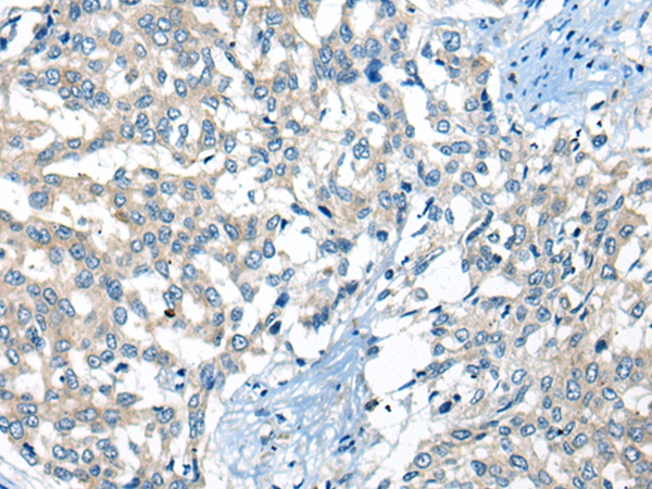 FAM129C Antibody