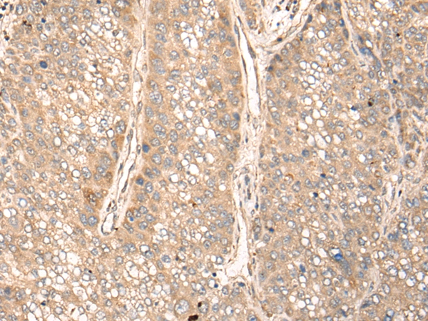 GPANK1 Antibody