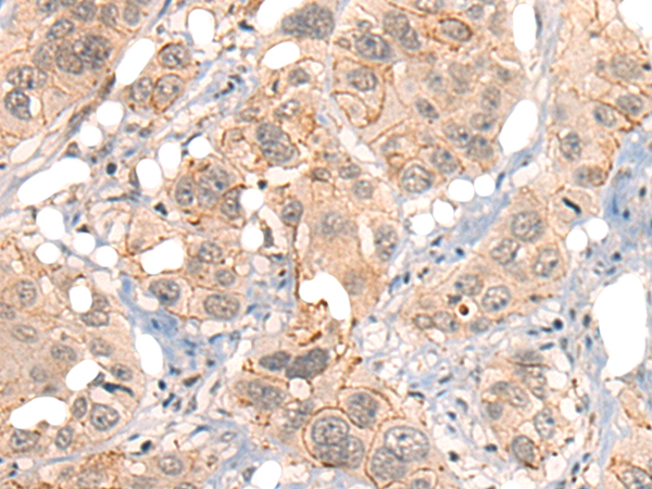 GPR55 Antibody